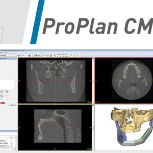 CMF Proplan 3 – 3D Surgical Planning Software for CMF