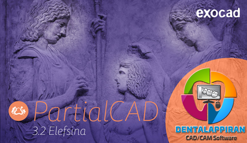 Exocad PartialCAD 3.2 – Partial Denture Design Software